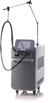 ジェントルMAX Proでメンズ脱毛